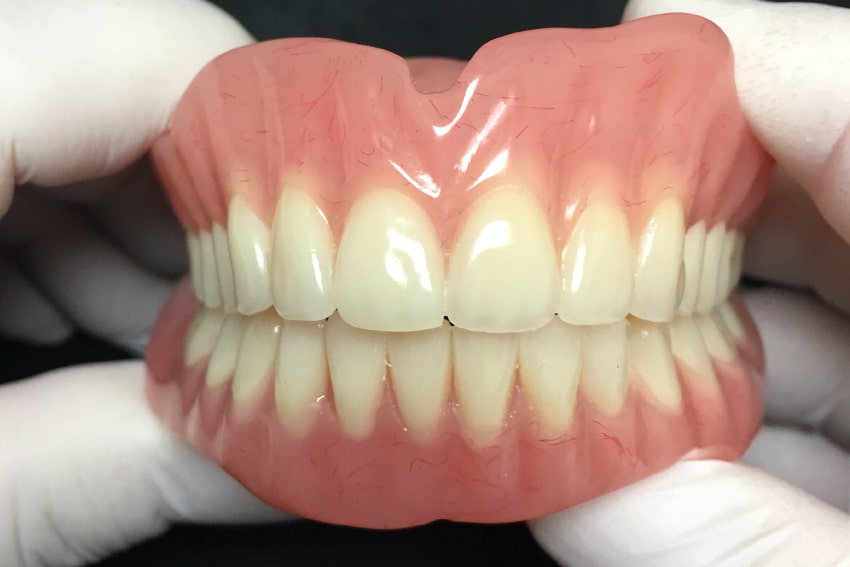 Dentures & Partials Tepe Dentistry Colleen Tepe Hofstetter, DDS